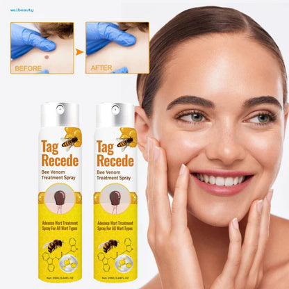 2x1 LOVILDS™  Eliminador de Verrugas y Manchas